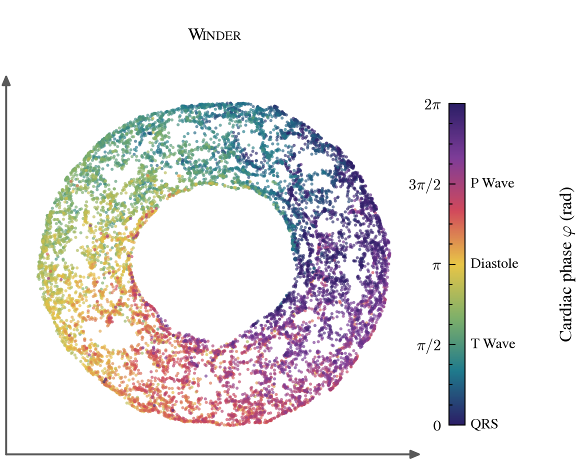 Scatter plot of Winder's latent representation forming a ring coloured by true cardiac phase from QRS through T wave, diastole and P wave.